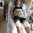图为：雷晨磊正躺在病床上养伤。　钟李佳　摄 - 浙江新闻网